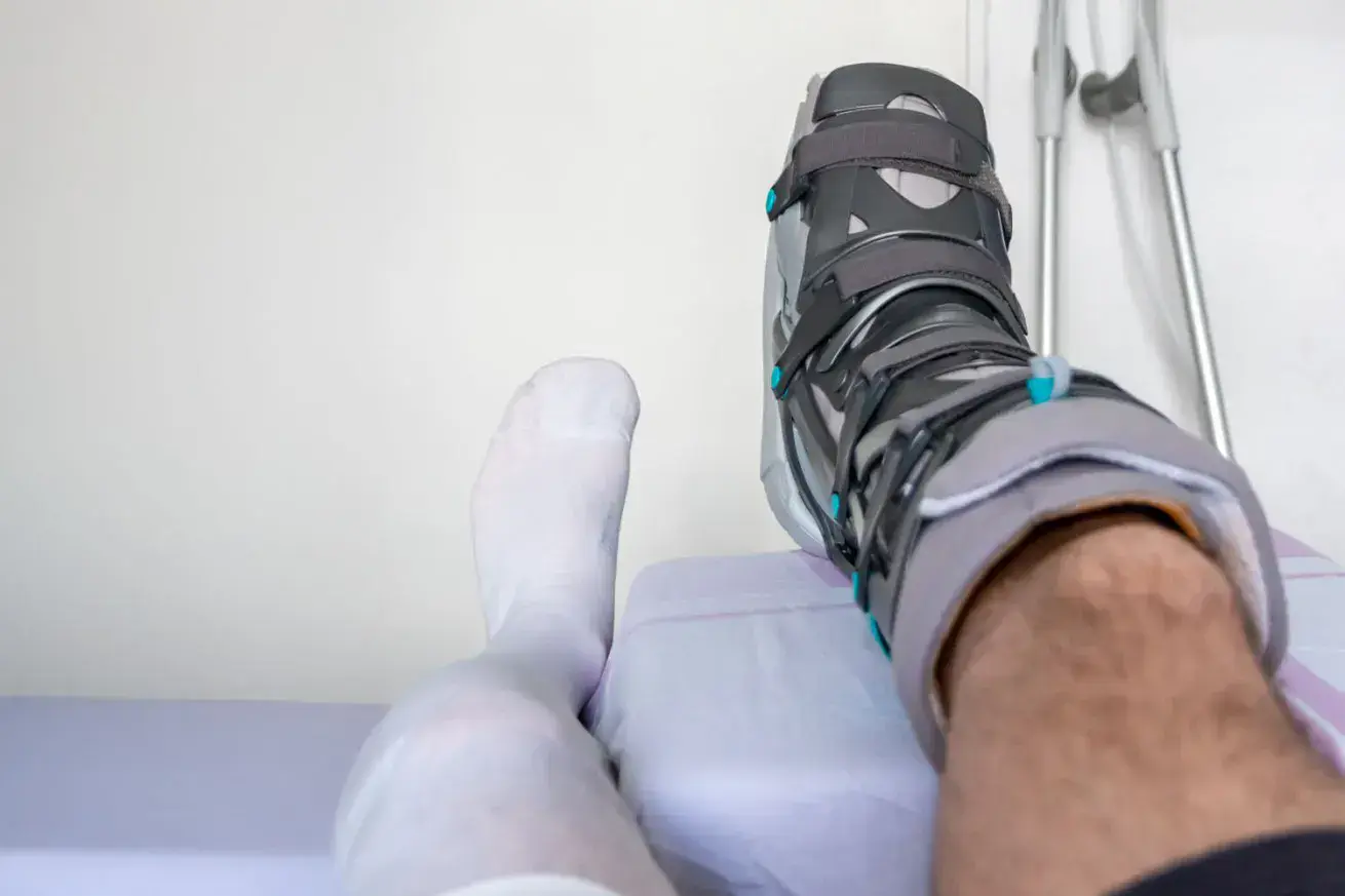 man after achilles tendon rupture
